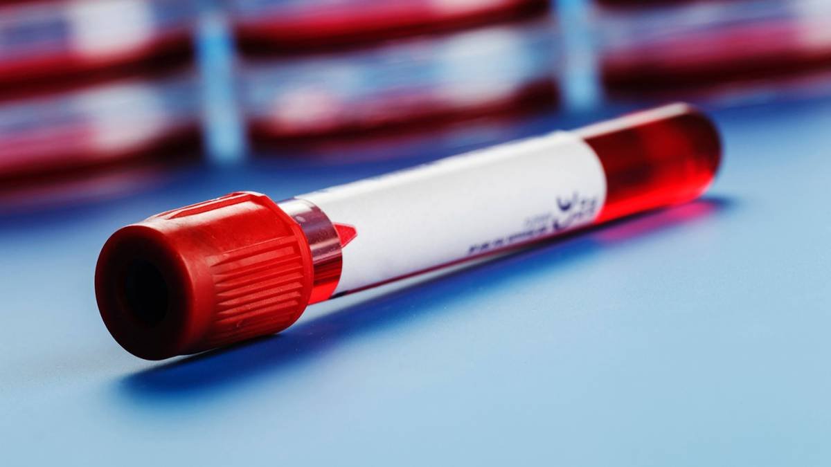 México quiere ser el primer país de América Latina en erradicar la hepatitis C, en 2030