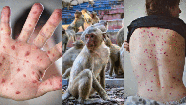 f800x450-584116_635562_5050