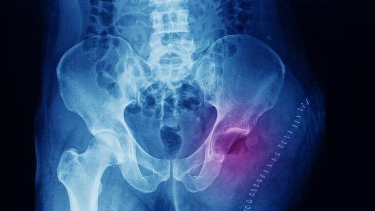 2TYSHPI2CBGBZJ56LZDMXVXAIQ