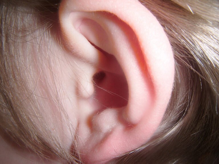 EAR
