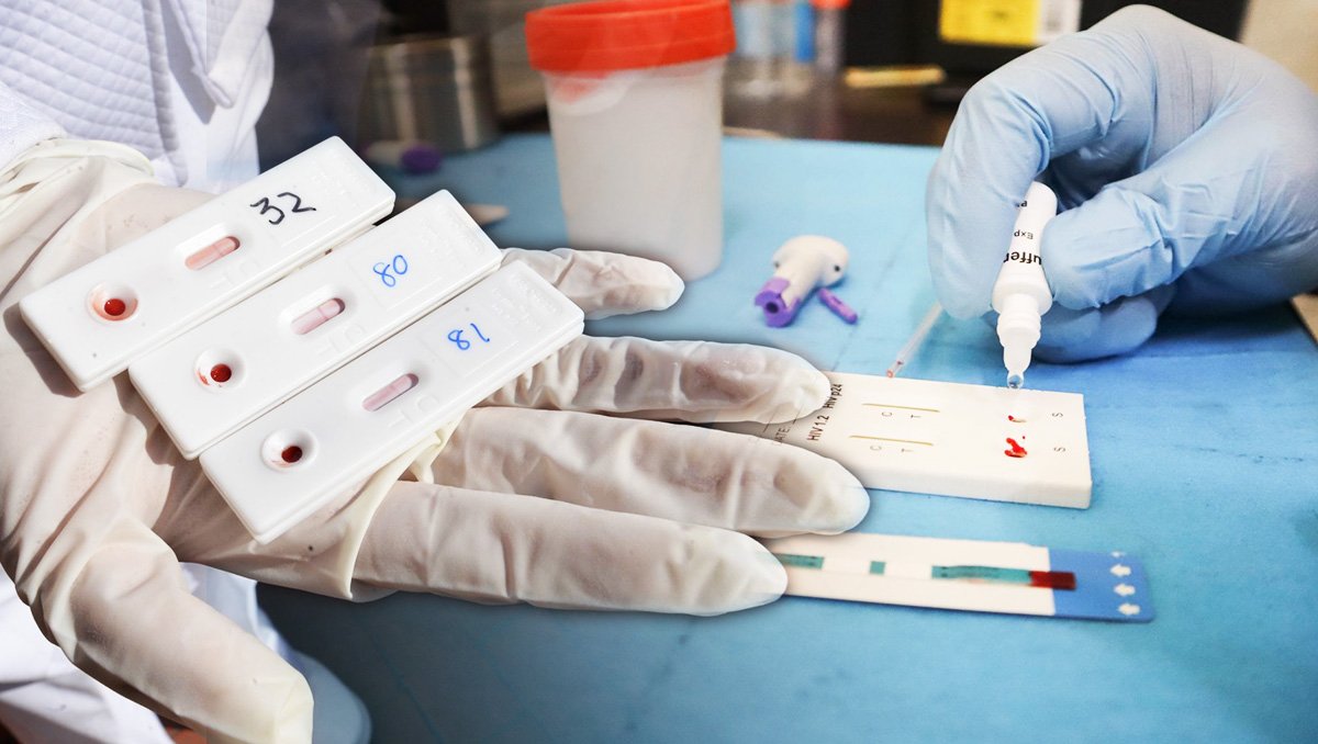 Yucatán supera los 3 mil 700 casos de VIH-SID