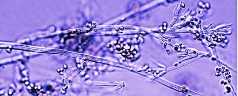 Marquandomyces-marquandii-Hongo