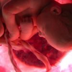 cordon-umbilical-Embarazo-Bebe-Feto