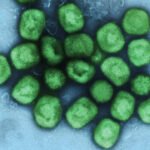 Colorized_transmission_electron_micrograph_of_monkeypox_virus_particles_(green)