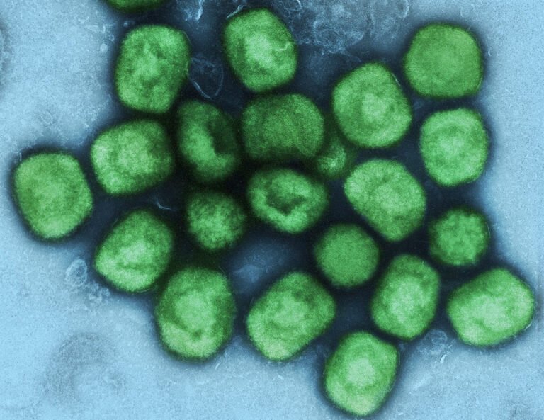 Colorized_transmission_electron_micrograph_of_monkeypox_virus_particles_(green)