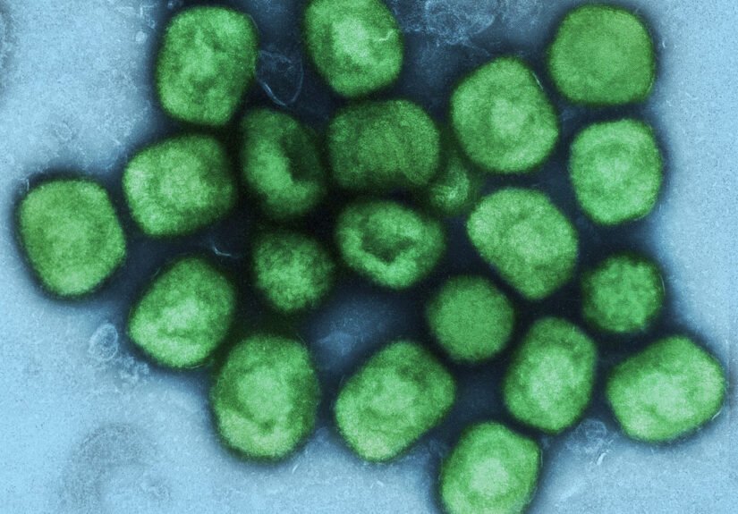 Colorized_transmission_electron_micrograph_of_monkeypox_virus_particles_(green)